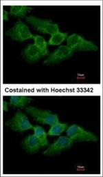 MKRN2 Polyclonal Antibody