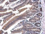 SH3BP1 Antibody in Immunohistochemistry (Paraffin) (IHC (P))