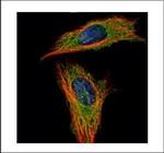 RABGAP1 Polyclonal Antibody