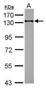 RABGAP1 Antibody in Western Blot (WB)