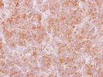 TRIM29 Antibody in Immunohistochemistry (Paraffin) (IHC (P))