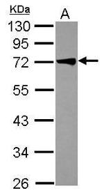 TRIM29 Antibody in Western Blot (WB)