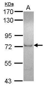 ZFP95 Polyclonal Antibody