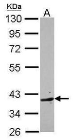 BHMT2 Antibody in Western Blot (WB)