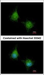 EML2 Polyclonal Antibody