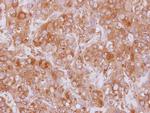 EML2 Antibody in Immunohistochemistry (Paraffin) (IHC (P))