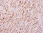 FUS2 Antibody in Immunohistochemistry (Paraffin) (IHC (P))