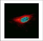 L3MBTL1 Polyclonal Antibody