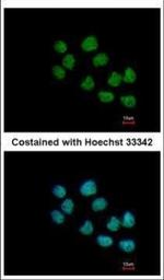 CREST Polyclonal Antibody