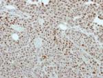 CREST Antibody in Immunohistochemistry (Paraffin) (IHC (P))