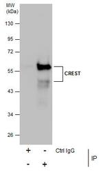 CREST Antibody in Immunoprecipitation (IP)