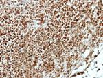 APPL1 Polyclonal Antibody
