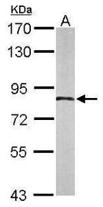 APPL1 Polyclonal Antibody
