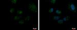 DECR2 Polyclonal Antibody