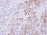 ARL5A Polyclonal Antibody