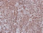 FBXL4 Polyclonal Antibody