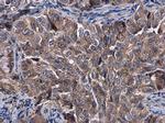 KLHL3 Polyclonal Antibody