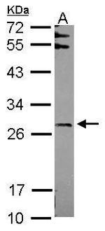 FBXO6 Antibody in Western Blot (WB)