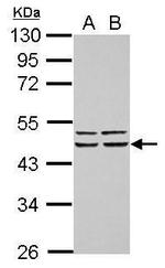 FBXO4 Antibody in Western Blot (WB)