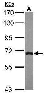 ARFGAP3 Antibody in Western Blot (WB)