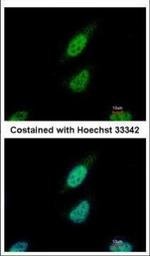 NARF Polyclonal Antibody