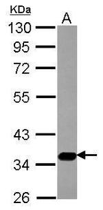 SLC17A5 Antibody in Western Blot (WB)