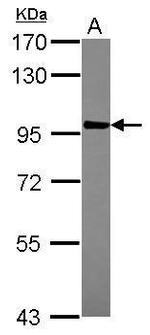 AKAP8L Polyclonal Antibody