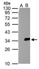 TZFP Polyclonal Antibody