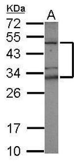 TZFP Antibody in Western Blot (WB)