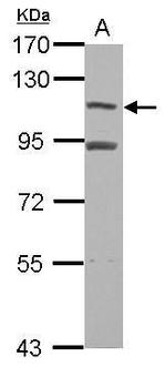 MTBP Antibody in Western Blot (WB)