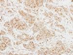 CLUL1 Polyclonal Antibody