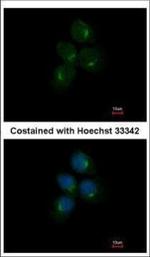 CHIA Polyclonal Antibody