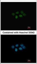 MAT2B Polyclonal Antibody