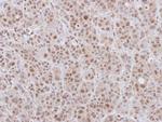 DCPS Polyclonal Antibody