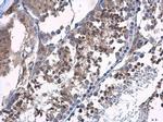 HOOK2 Antibody in Immunohistochemistry (Paraffin) (IHC (P))