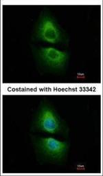 PSAT1 Polyclonal Antibody