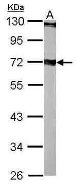 Septin-9 Antibody in Western Blot (WB)