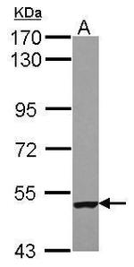 Septin-9 Antibody in Western Blot (WB)