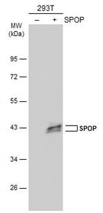 SPOP Polyclonal Antibody