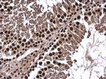 FUBP3 Antibody in Immunohistochemistry (Paraffin) (IHC (P))