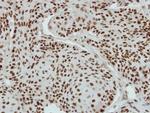 FUBP3 Antibody in Immunohistochemistry (Paraffin) (IHC (P))