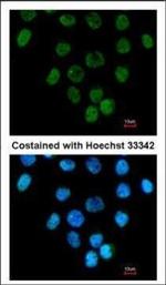 CARP Polyclonal Antibody