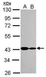 CARP Antibody in Western Blot (WB)