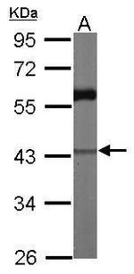 CARP Antibody in Western Blot (WB)
