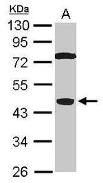 SPO11 Antibody in Western Blot (WB)