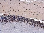 PHAP I Antibody in Immunohistochemistry (Paraffin) (IHC (P))