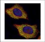 VPS28 Polyclonal Antibody