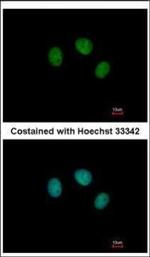 ZNF345 Polyclonal Antibody