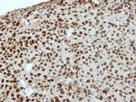 ZNF345 Antibody in Immunohistochemistry (Paraffin) (IHC (P))