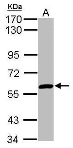 ZNF345 Antibody in Western Blot (WB)